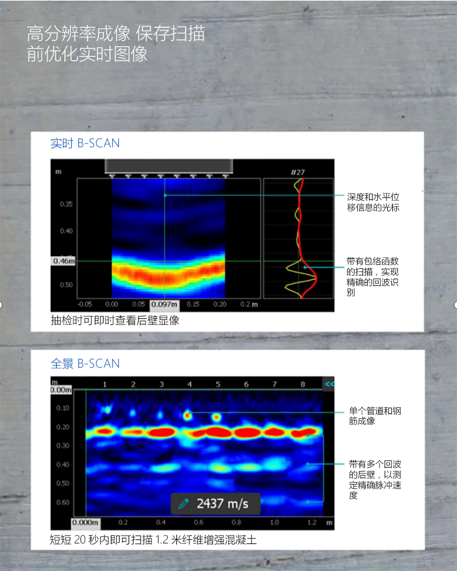 超聲成像掃描儀優(yōu)勢